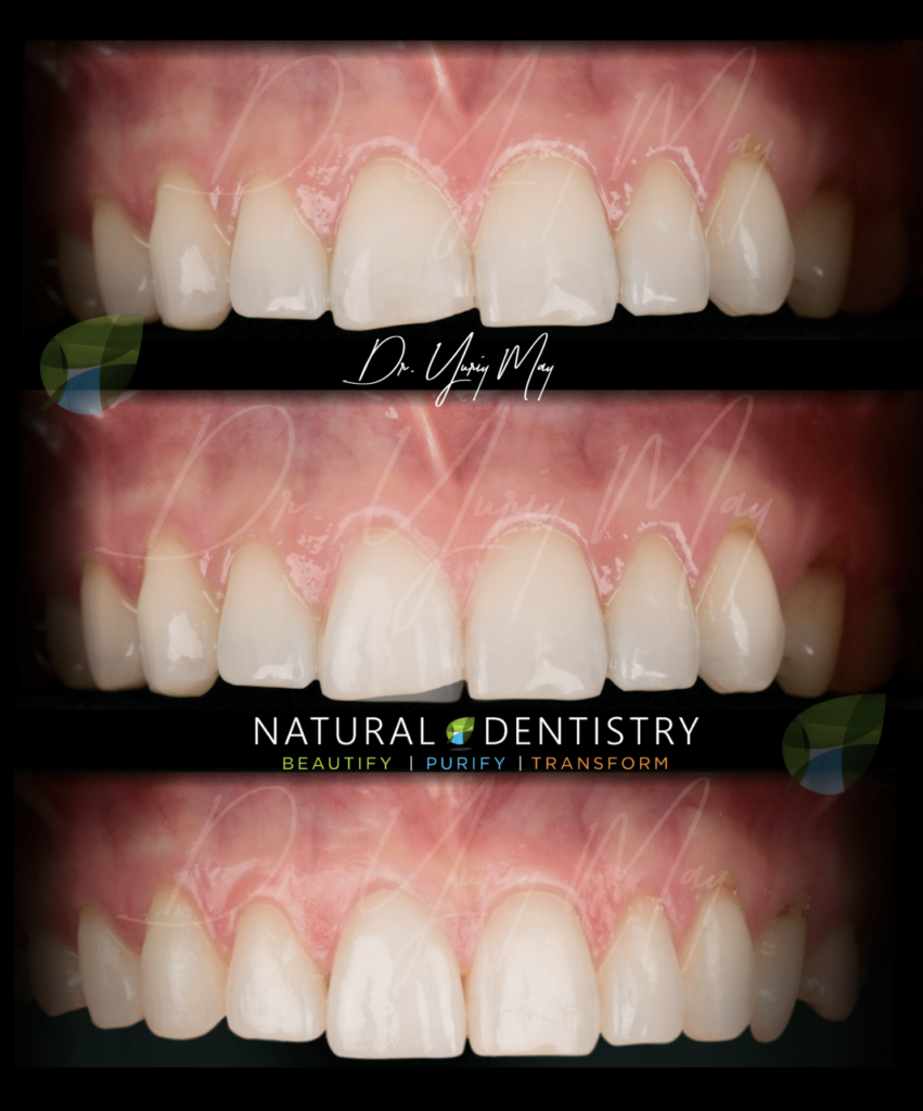 San diego dentist natural