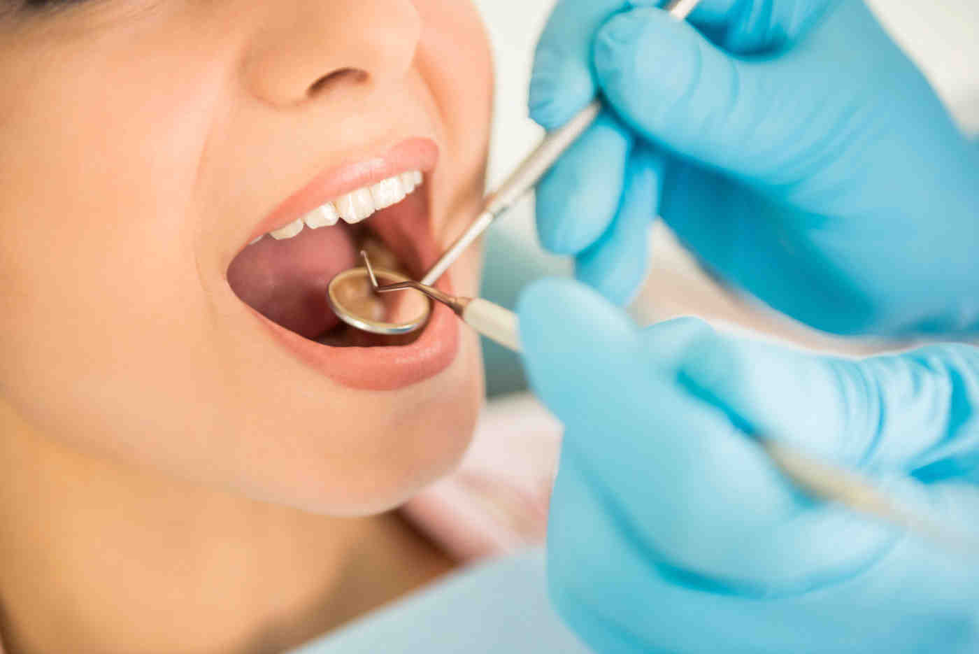 What is the cheapest way to fix your teeth?