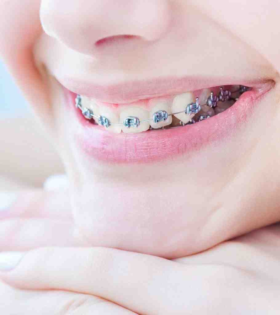 Good dentists in san diego dentists to get braces