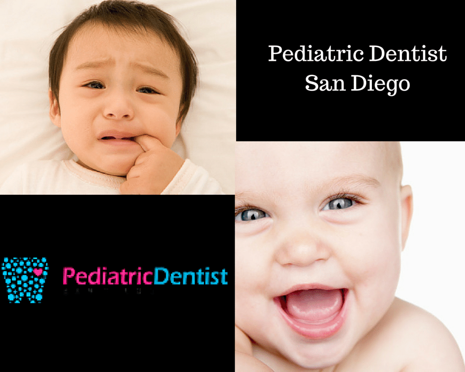 Best Pediatric Dentist San Diego Elite Dentists