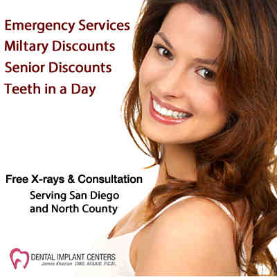 San diego implant dentists